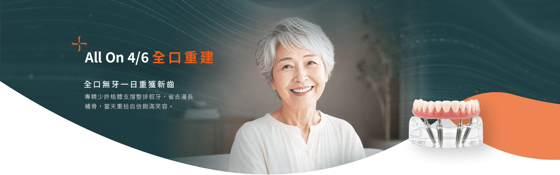 All on 4/6 全口重建 All on 4/6 全口重建